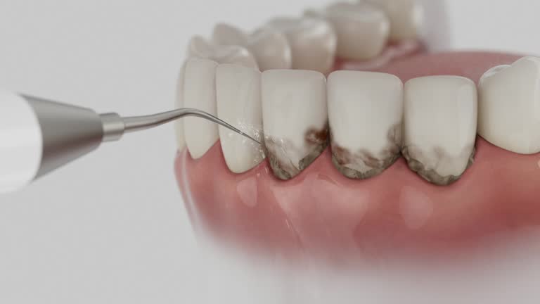 Trusted Teeth Cleaning And Checkup service in Boyes Hot Springs, CA - Dentist Open Now